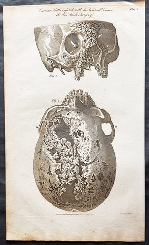 1798 William Henry Hall Large Antique Print of a Syphilitic Human Skull